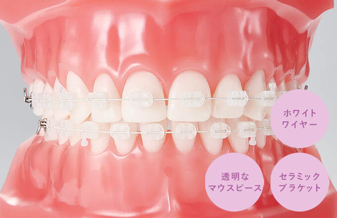 目立ちにくい矯正